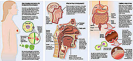 cancer diagram artwork medical illustration of cancer