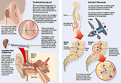 diagram of the ear medical ear illustration artwork