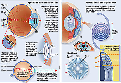 diagram of the eye eye illustration medical diagram