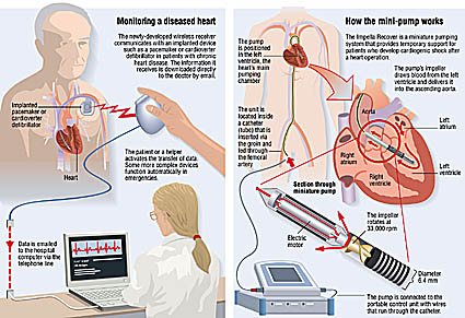 medical illustration of heart heart diagram medical illustration